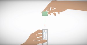 Cancer screening programs massively reduce risk of death