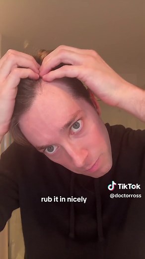 How to Apply Minoxidil Foam for Hair Growth