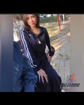 The beautiful girl with an amputated arm, the challenge of being disabled with one arm #amputada