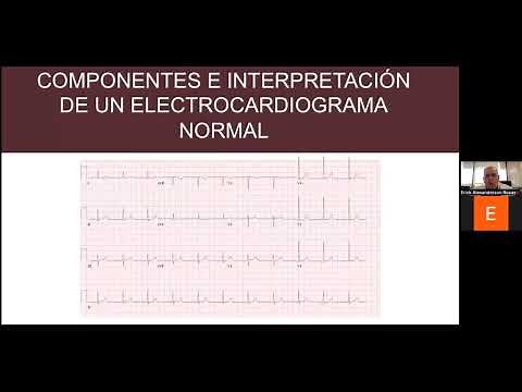 Electrocardiograma normal