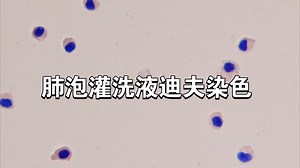 【实验】肺泡灌洗液迪夫染色