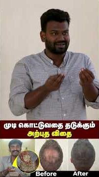 120 ரூபாய் செலவு பண்ணா போதும் | முடி கரு கருன்னு வளரும் 😍😍| Best seed for hair growth | Follicle.