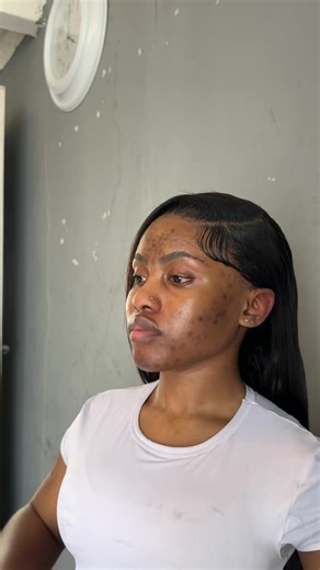 DIY Thinamac Installation Guide