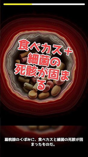 衝撃！口臭がうんこの匂いの人の秘密！
