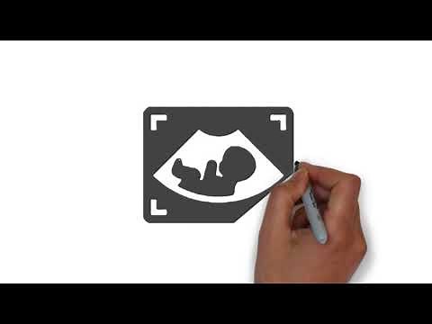 Prenatal Testing Options