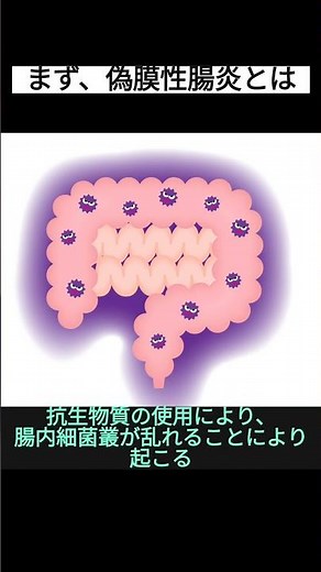 偽膜性腸炎#看護師 #勉強 #看護学生