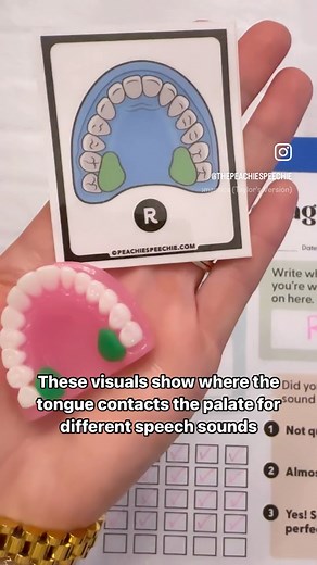 Palatograms can be SO HELPFUL in articulation therapy sessions!! This set of palatogram visuals is f r e e with the Peachie Speechie mini mouth model sets! https://peachiespeechie.com/products/peachie-speechie-mini-mouth-models | Peachie Speechie