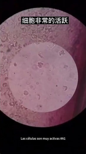 #microscopio #aumento