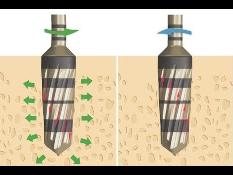 Osseodensification system in dental implant surgery