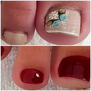 A much relaxing and needed pedicure transformation!🥰 | MetDaan Nails