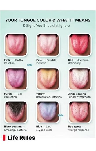 What Your Tongue Color Says About Your Health
