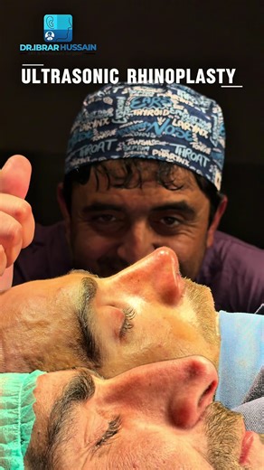 Rhinoplasty Insights from Dr. Ibrahim Hussain