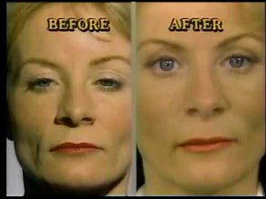 Amazing Discoveries Sudden Youth infomercial (1991)