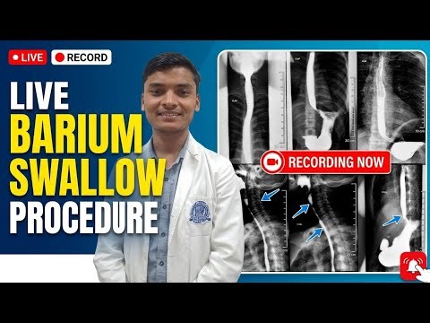 X-RAY BARIUM PROCEDURE LIVE