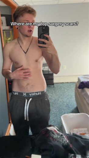 I’m very very happy with my results of the question I get often and I wanted to make sure people know that there’s more than one option for top surgery. Here are the three main categories. I try to explain them and why I chose this one, but unfortunately, not every top surgery is possible for everybody type of make sure you go to a reputable surgeon and the one that can give you the best results for your specific needs! . Even though I got top surgery with the specific surgeon through the peri m