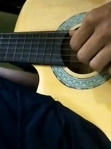 Hyperhidrosis Ruins Guitar Strings in 2 Days — Fingerstyle Struggle