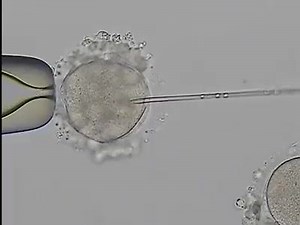 La Fécondation in vitro | TOUTE LA BIOLOGIE