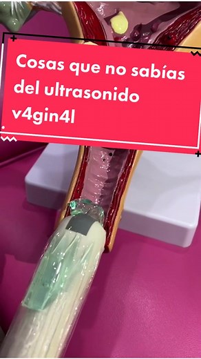 Todo sobre el ultrasonido v4gin4l: procedimiento, funcionamiento y usos