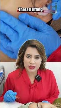 Procedure Thread Lifting