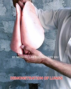 17 reactions · 3 comments | Function of the lungs DEMONSTRATION #science #medicallaboratoryscientist #medical #viralreels #viralshorts #vairalvideo #medicallaboratoryscience #lungscare #KarakoramInternationalUniversity Shabbir Hussain Harfan | Medical laboratory sciences | Facebook