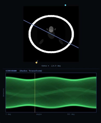 Radon Transform Visualized!