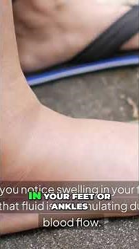 7 Leg Circulation Warning Signs You Must Know!