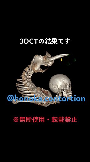 前回投稿した3DCTの結果画像です。 #コントーション #ストレッチ #トレーニング #トレーニング女子 #サーカス #ハンドバランス #後屈 #軟体 #柔軟 #研究 #contortion #flexible #flexibility #stretch #training #circus #Honoka #ct #ctscan #3dct