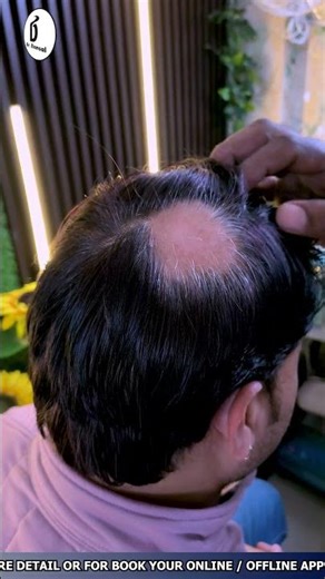 I Tried Hair Treatment for 30 Days and Here's My SHOCKING Review