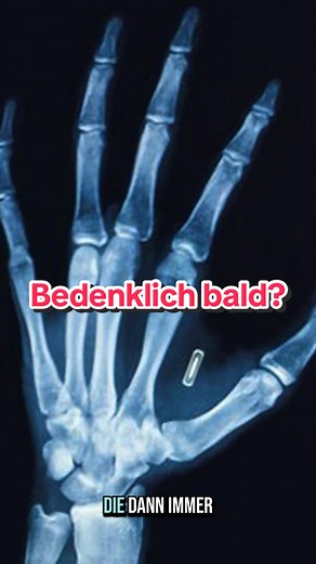 Was sagst du? Spinnerei oder bald Wirklichkeit? #prophezeiung #elonmusk #billgates #endzeit #2025 #glaube #gott #jesus #bibel #religion #christentum #jesuschristus #evangelium #christ #christus #christen #christentiktok #jesusrettet #jesusistgott #viral #viralvideos #viralvideotiktok #trends #trendy #fyp #fy #foru #forupage #foryou #foryoupagе