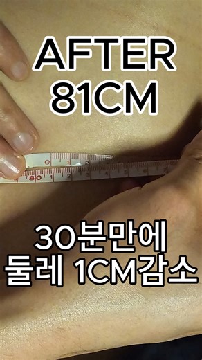 @pythia_apgujung on Instagram: "30분 복부 케어, 몇 초 안에 압축했습니다. 살을 빼는 장면이 아니라 ✔ 붙어 있던 근막이 풀리고 ✔ 막혀 있던 순환이 열리고 ✔ 라인이 정리되는 과정. 피티아의 30분은 겉만 자극하는 시간이 아닙니다. 구조를 바꾸는 30분, 눈으로 보이는 건 몇 초. 고주파 · 음압 · 수기 복부 라인을 다시 설계하다. 📍 Apgujeong PYTHIA 📩 예약은 네이버플레이스에서! #피티아 #피티아고주파 #30분케어 #몇초의변화 #복부관리 #복부라인 #고주파복부 #음압케어 #근막케어 #림프순환 #라인설계 #체형관리 #압구정에스테틱 #압구정고주파 #릴스추천 #눈에보이는변화"