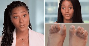 'My Feet Are Killing Me' Season 4: Can Dr Ebonie fix a young girl's webbed toes without losing one?