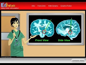 Edheads Deep Brain Stimulation Game Play