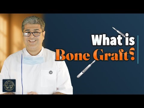 What is Implant Bone Graft Powder Types, Uses, and Key Points