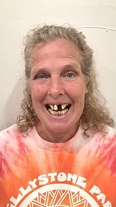 4.9K views · 30 reactions | Your smile story begins with one SIMPLE step. 凉 Click the "Learn more" button to see if you may be eligible for Permanent Teeth in 24 Hours ✅醴 #smile #new #teeth #permanentteeth #dentalimplants #love | Nuvia Dental Implant Center | Facebook