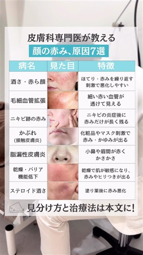 顔の赤み、放置してない？#皮膚科専門医 #美容皮膚科 #上野御徒町ファラド皮膚科 #顔の赤み