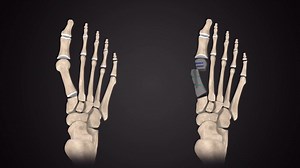 Animation 3D - Centrolock