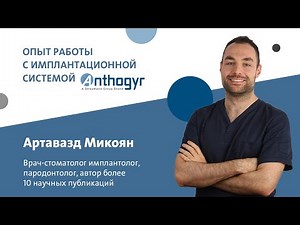Артавазд Микоян: Опыт работы с имплантационной системой Anthogyr