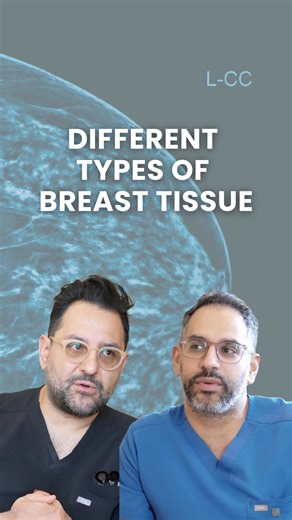 Daniel Niku, MD, MS on Instagram: "Breasts are made up of two components: fat and fibroglandular (or glandular) tissue. Depending on how much of each you have, your breast density is classified into four categories on a mammogram: 1. Fatty (Type 1): Mostly fat—only about 10% of women fall into this category. 2. Scattered fibroglandular tissue (Type 2): A mix of fat and some glandular tissue, seen in about 40% of women. 3. Heterogeneously dense (Type 3): About 50–75% dense tissue—also around 40% 