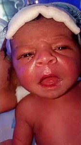 ABO incompatibility #lifeisbutadream #cutebaby