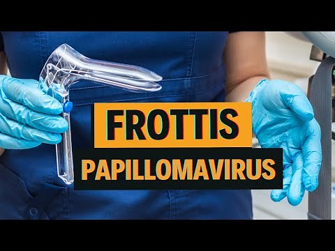 Cancer du col de l'utérus - Trouver et soigner