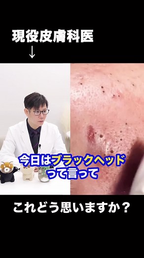 ブラックヘッドのケア方法と対処法の解説