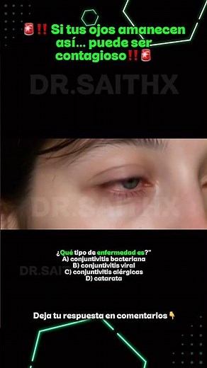 Conjuntivitis viral
