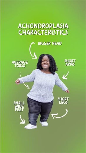 Achondroplasia: Head to Toe Characteristics! 💚 #Spock #Dwarfism #DwarfismAwareness #LittlePerson