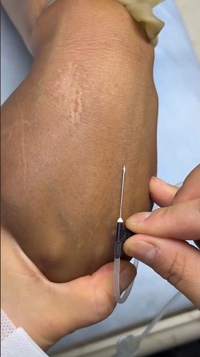How to Give IV Injection | Intravenous Safe & Easy Method | Perfect IV & Intramuscular IM #shorts