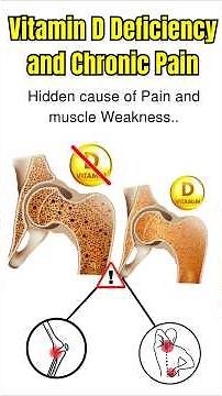 Vitamin D Deficiency & Chronic Pain | The Hidden Cause of Muscle Weakness?