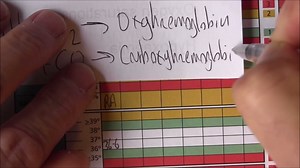 National Early Warning Score 2, Highs and lows | Dr. John Campbell