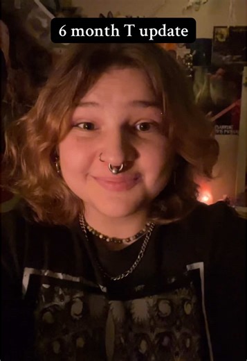 6 Month Testosterone Update for Transmasc Journey