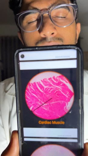 MANISH | MBBS STUDENT on Instagram: "Flashcards for histology slides✅ . [mbbs, hospital life ,medical college,med school,hostel life, life ,college,life,life,follow,rant,this,journey,struggles,fun,masti,trend,hospital,exams,mbbs life,medical college fun, exam struggles of medical students] . #challenge #mbbs #medicalstudent #trend #struggles #health #healthiswealth #hospital #funny #mbbslife #hostellife #fun #medicalcollege #1styearmbbs #1stdayofcollege"