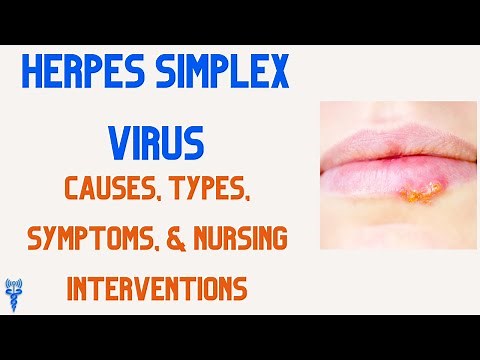 HERPES SIMPLEX VIRUS Nursing Interventions, Causes, & Types