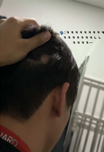 원형탈모 고민과 일상 이야기
